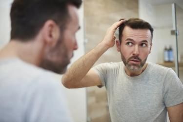 How to Avoid Hair Loss on TRT: Causes, Prevention, and Treatment