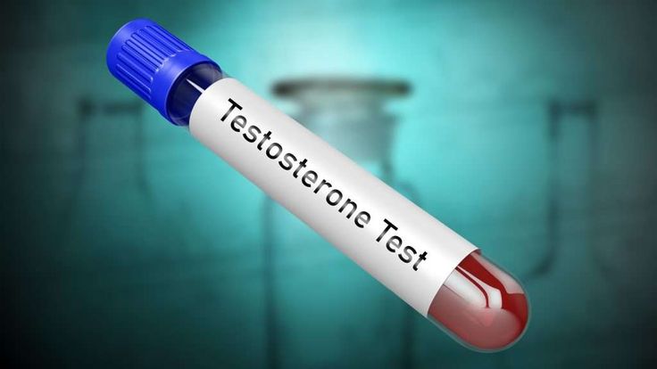 How to test testosterone